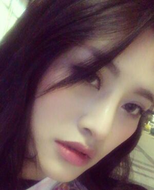 趙煜楠給做的隆鼻整形，看看我鼻子果怎么樣