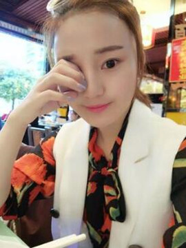 終于做了顴骨內(nèi)推了還是在北京八大處果我放心