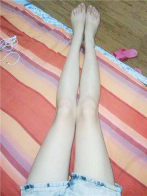 去年東方和諧張準(zhǔn)醫(yī)生做的大腿抽脂，分享一下我的前后對(duì)比果圖片！