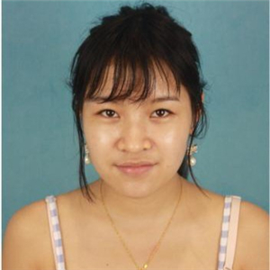 在米揚(yáng)麗格做的自體軟骨隆鼻，巫文云院長的技術(shù)棒棒噠！