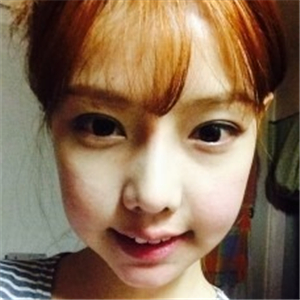 米揚(yáng)麗格夏正義做雙眼皮果怎么樣？看看我的前后對(duì)比果圖片吧！