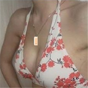 南昌同濟(jì)做的極速動(dòng)感微創(chuàng)豐胸術(shù)，分享下我的恢復(fù)過程圖片吧~