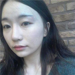 趙雅雄做下頜角整形成好嗎？看看我的前后對(duì)比圖片就知道了~