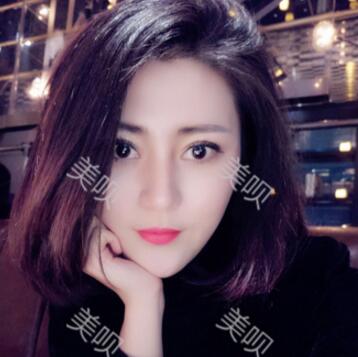 自體脂肪隆鼻+割雙眼皮恢復(fù)后的果我很滿意