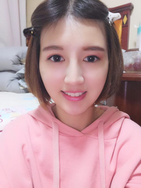 注射瘦臉去抬頭紋，找回屬于我的年齡，感謝金頌良醫(yī)生！