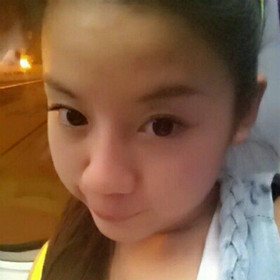 面部吸脂手術(shù)前后過程圖片,真實案例分享