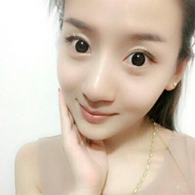 面部吸脂手術(shù)前后過程圖片,真實案例分享