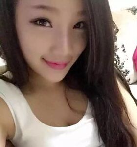 徐和林醫(yī)生給我注射玻尿酸隆鼻后顏值up