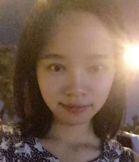 全切雙眼皮+去脂肪，終于擺脫小眼睛了