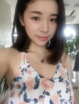 合肥楊鵬隆鼻整形真實(shí)案例分享