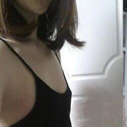 自體脂肪隆胸真的變大胸了 感謝成都天使之翼