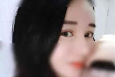 成都天使之翼做的雙眼皮修復怎么樣 快來圍觀