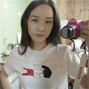 去年在格萊美做了頭發(fā)種植，看看前后對比和恢復果照片吧~~