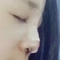 將自己隆鼻恢復過程分享給大家，希望對有需求的MM有幫助