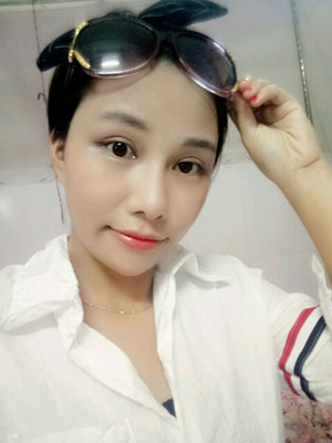 美萊鄧正輝做的切開雙眼皮 終于變美了