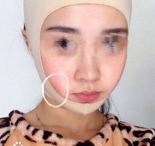 磨骨瘦臉后，終于擺脫大餅?zāi)樍耍? /> </a>
										<a href=