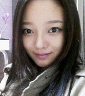 假體隆鼻手術(shù)過程前后對(duì)比圖片