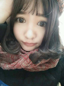 去年12月初在南京韓辰做的雙眼皮，大家來(lái)看看果怎么樣?