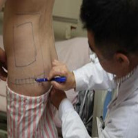 抽脂減肥瘦小腹 終于可以不用節(jié)食鍛煉了