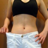 抽脂減肥瘦小腹 終于可以不用節(jié)食鍛煉了