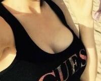 假體隆胸價(jià)格和恢復(fù)過程前后對比圖