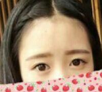 一次性做了全切雙眼皮和開內(nèi)眼角兩項(xiàng)整形，佩服自己的勇氣