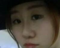 同學(xué)做了隆鼻，我也去做了個(gè)假體隆鼻，臉型真心立體了好多