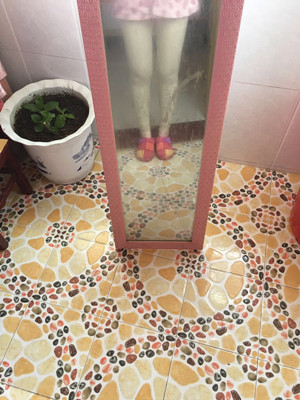 王世虎做的吸脂瘦大腿 果很明X