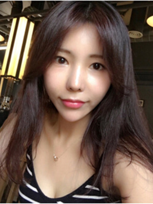 玻尿酸去除法令紋后人生明朗了 軍美王世虎做的