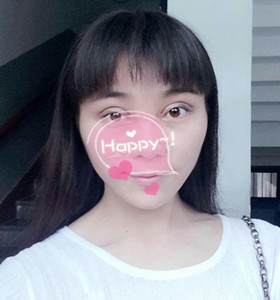 南京康美張讓虎醫(yī)生給我做的眼部綜合整形，大家來看看怎么樣