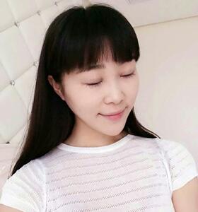 南京康美張讓虎醫(yī)生給我做的眼部綜合整形，大家來看看怎么樣