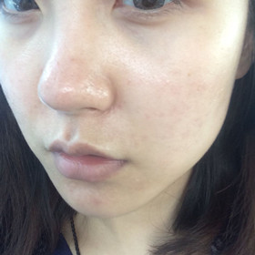 做了黑臉娃娃后，Duang的一下就變成“白雪公主”啦