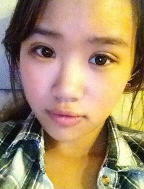 曼托毛面假體隆胸后我也是大胸妹子啦