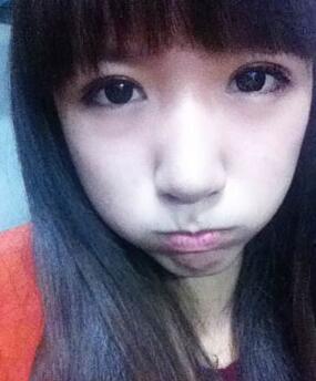 北京常好麗格三點定位雙眼皮恢復一個月經(jīng)歷