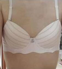 北京常好麗格三點定位雙眼皮恢復一個月經(jīng)歷