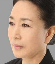 拉皮除皺手術(shù)讓我年輕20歲