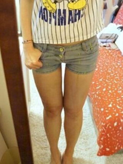 吸脂瘦大腿讓我變回纖纖細(xì)腿