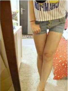 吸脂瘦大腿讓我變回纖纖細(xì)腿