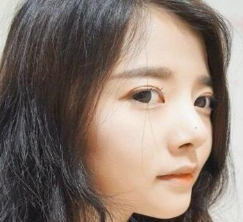 硅膠隆鼻手術(shù)圓了我高鼻梁的夢(mèng)