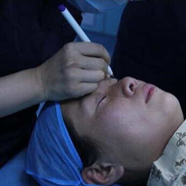 雙眼皮手術(shù)讓我單眼皮變雙眼皮就是這么簡單