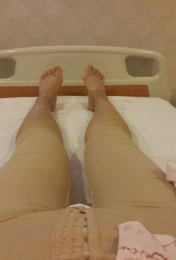 水動(dòng)力吸脂瘦大腿讓我夏天放肆嗨