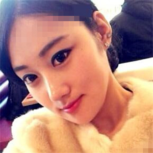 看看我磨下頜角整形手術(shù)恢復(fù)前后的對(duì)比圖片，同學(xué)都說我像張馨予~~