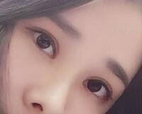 切開雙眼皮價格2680元，費用不貴果卻很好