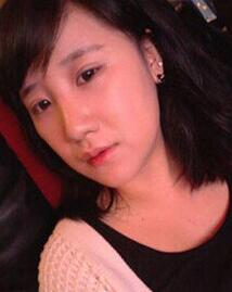 北京清木隆鼻+雙眼皮恢復日記