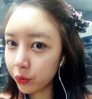 北京清木隆鼻整形后 **變身