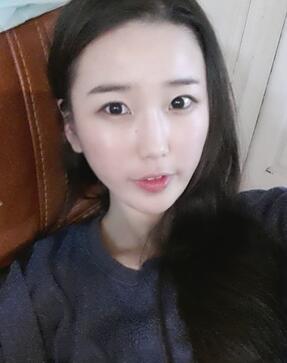 北京清木自體脂肪豐面頰2個(gè)月果分享