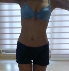 北京清木腰腹吸脂3個(gè)月感受