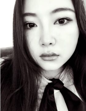 天津美萊吳勝做的硅膠假體隆鼻還墊鼻尖了