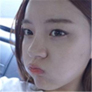 注射美白k氧注射針后一個療程的果照片，你們看前后對比，變化很大吧~