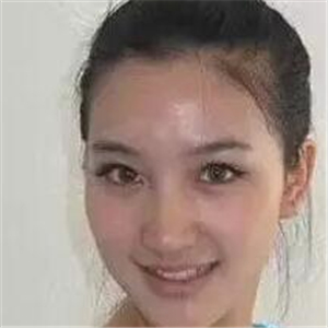 去年做的注射B****微整形，你們看看恢復(fù)前后的對比照片~~~